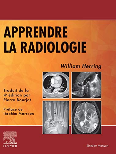 Apprendre la radiologie von Elsevier Masson