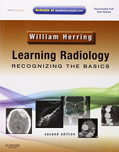 Learning Radiology: Recognizing the Basics (With STUDENT CONSULT Online Access)