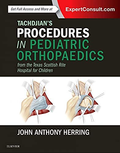 Tachdjian's Procedures in Pediatric Orthopaedics: From the Texas Scottish Rite Hospital for Children von Elsevier