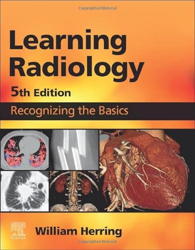 Learning Radiology: Recognizing the Basics