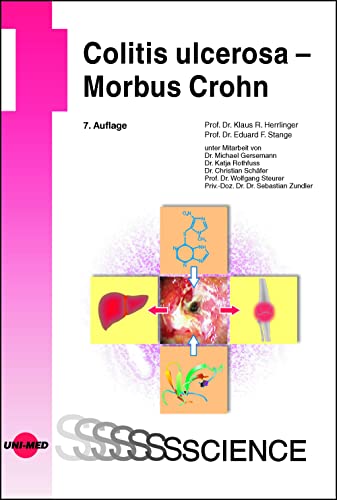 Colitis ulcerosa – Morbus Crohn (UNI-MED Science) von UNI-MED