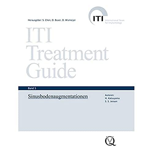ITI Treatment Guide Band 5: Sinusbodenaugmentationen (ITI Treatment Guide: Deutsche Ausgabe)