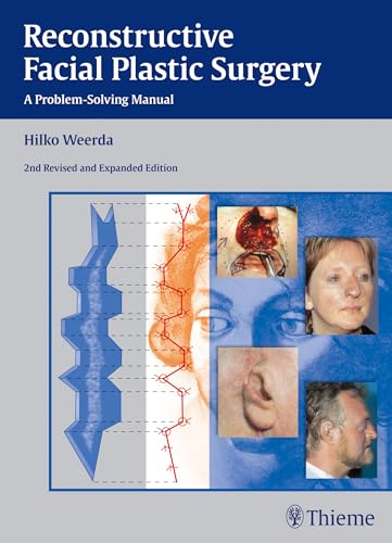 Reconstructive Facial Plastic Surgery: A Problem-Solving Manual von Thieme