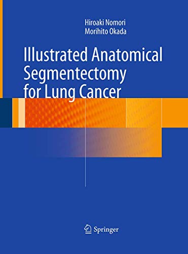 Illustrated Anatomical Segmentectomy for Lung Cancer Illustrated Anatomical Segmentectomy for Lung Cancer von Springer