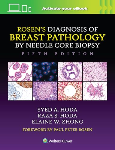 Rosen's Diagnosis of Breast Pathology by Needle Core Biopsy von Wolters Kluwer Health