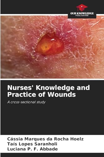 Nurses' Knowledge and Practice of Wounds: A cross-sectional study von Our Knowledge Publishing