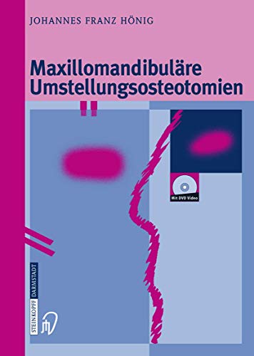 Maxillomandibuläre Umstellungsosteotomien (German Edition) von Springer