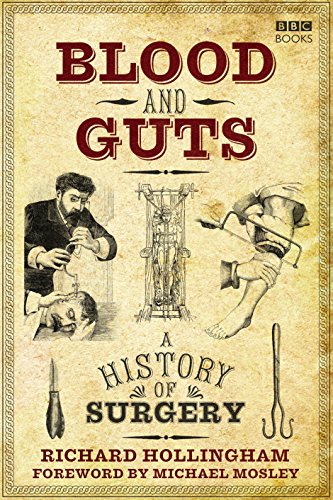 Blood and Guts: A History of Surgery von BBC