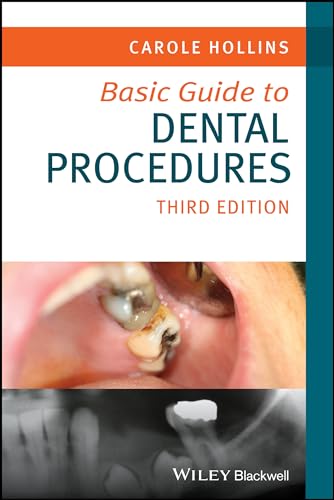 Basic Guide to Dental Procedures (Basic Guide Dentistry Series) von Wiley-Blackwell
