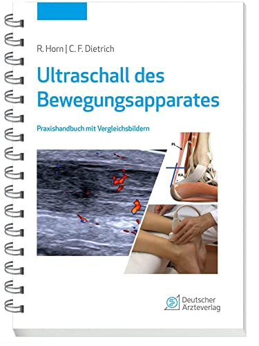 Ultraschall des Bewegungsapparates: Praxishandbuch mit Vergleichsbildern von Deutscher Aerzte Verlag