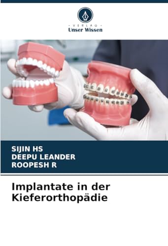 Implantate in der Kieferorthopädie von Verlag Unser Wissen