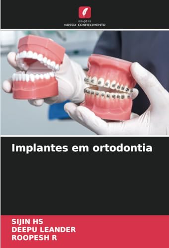 Implantes em ortodontia: DE von Edições Nosso Conhecimento