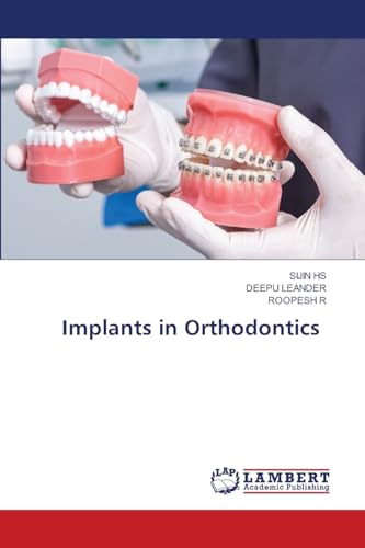 Implants in Orthodontics: DE von LAP LAMBERT Academic Publishing