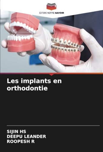 Les implants en orthodontie: DE von Editions Notre Savoir