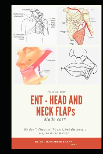 ENT - HEAD and NECK FLAPs MADE EASY: otolaryngology , head and neck reconstruction , ent board preparation , local regional and free flaps , ... and flaps book (ENT BOARD PREPARATION SERIES)