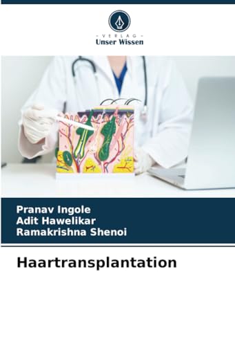 Haartransplantation: DE von Verlag Unser Wissen