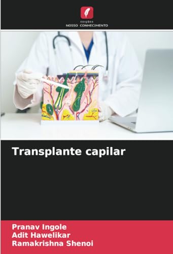 Transplante capilar: DE von Edições Nosso Conhecimento