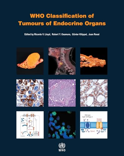 Who Classification of Tumours of Endocrine Organs (World Health Organization Classification of Tumours) von World Health Organization