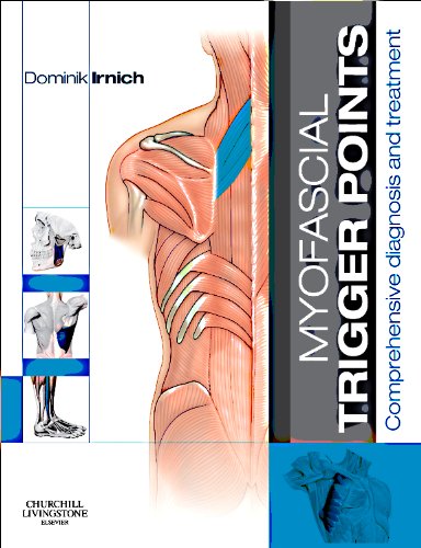 Myofascial Trigger Points: Comprehensive diagnosis and treatment von Churchill Livingstone
