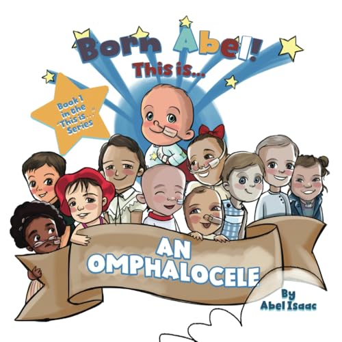 This Is... An Omphalocele ("This Is" Books Ser., Band 1)