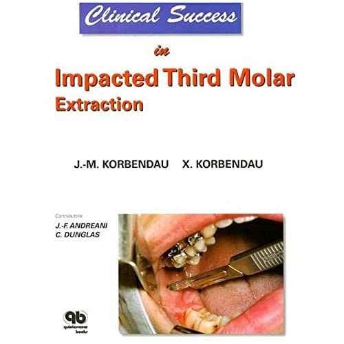 Clinical Success in Impacted Third Molar Extraction von Quintessence Publishing (IL)