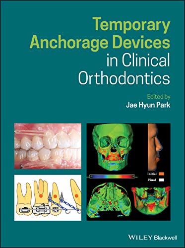 Temporary Anchorage Devices in Clinical Orthodontics von Wiley-Blackwell