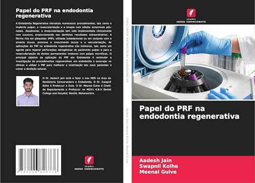 Papel do PRF na endodontia regenerativa: DE von Edições Nosso Conhecimento