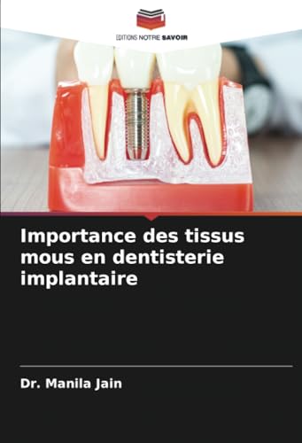 Importance des tissus mous en dentisterie implantaire von Editions Notre Savoir