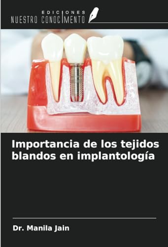 Importancia de los tejidos blandos en implantología von Ediciones Nuestro Conocimiento