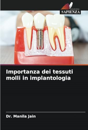 Importanza dei tessuti molli in implantologia von Edizioni Sapienza