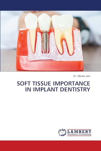 SOFT TISSUE IMPORTANCE IN IMPLANT DENTISTRY von LAP LAMBERT Academic Publishing