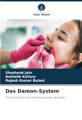 Das Damon-System: Eine Revolution bei selbstligierenden Brackets von Verlag Unser Wissen