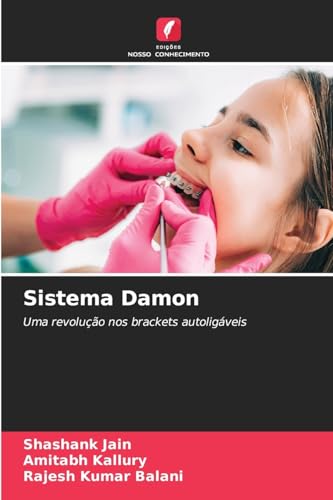 Sistema Damon: Uma revolução nos brackets autoligáveis