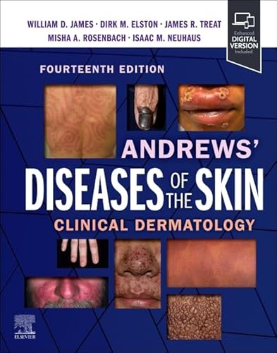 Andrews' Diseases of the Skin: Clinical Dermatology von Elsevier