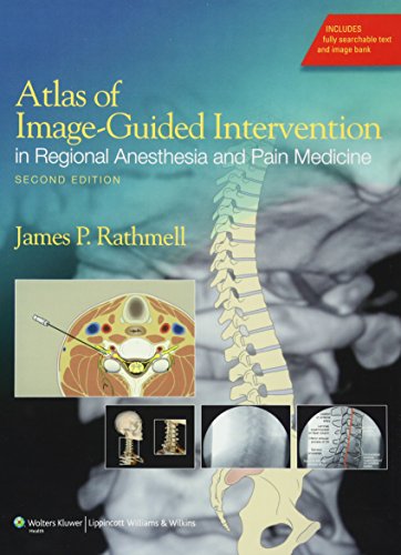 Atlas of Image-Guided Intervention in Regional Anesthesia and Pain Medicine von Lippincott Williams&Wilki