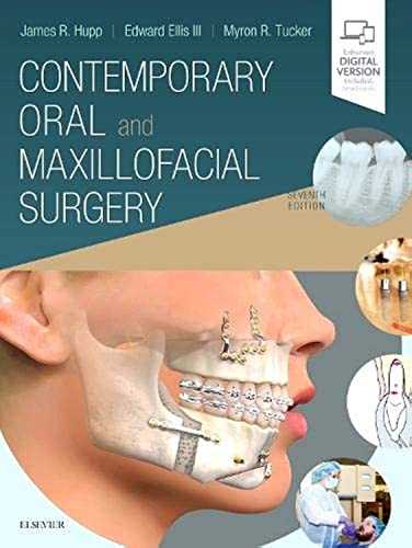 Contemporary Oral and Maxillofacial Surgery