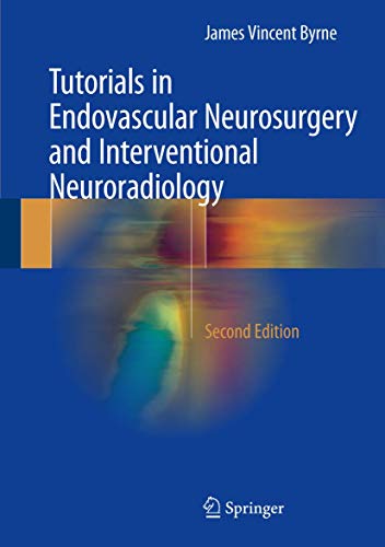 Tutorials in Endovascular Neurosurgery and Interventional Neuroradiology von Springer