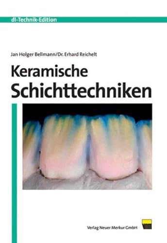 Keramische Schichttechniken von Neuer Merkur GmbH