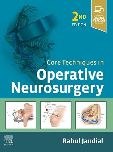 Core Techniques in Operative Neurosurgery: Expert Consult - Online and Print
