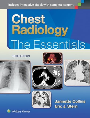 Chest Radiology: The Essentials Chest Radiology: The Essentials