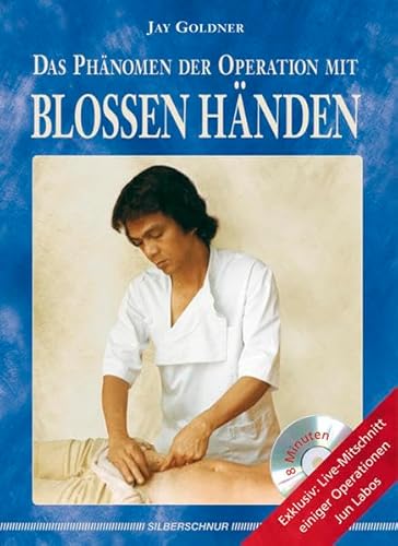 Das Phänomen der Operation mit blossen Händen, m. DVD von Silberschnur