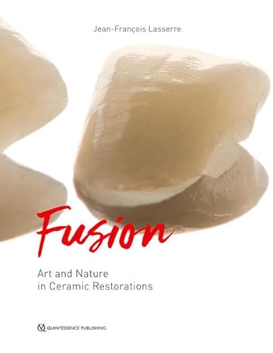 Fusion: Art and Nature in Ceramic Restorations von Quintessence Publishing