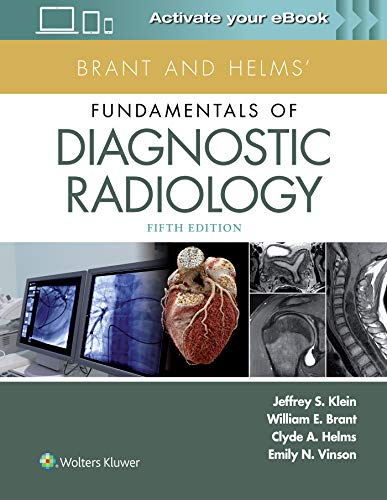 Brant and Helms' Fundamentals of Diagnostic Radiology Brant and Helms' Fundamentals of Diagnostic Radiology von Lippincott Williams & Wilkins