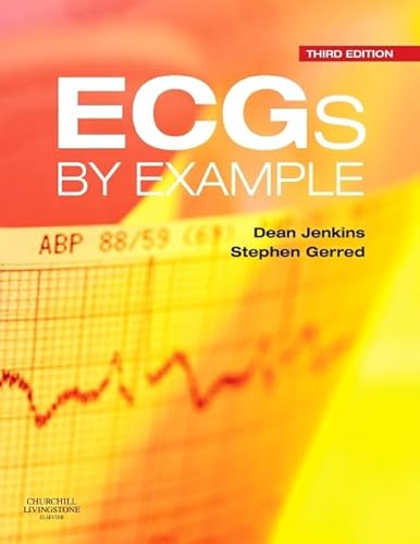 ECGs by Example von Churchill Livingstone