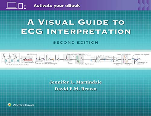 A Visual Guide to ECG Interpretation von LWW