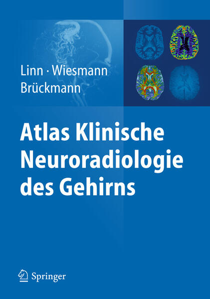 Atlas Klinische Neuroradiologie des Gehirns von Springer Berlin Heidelberg