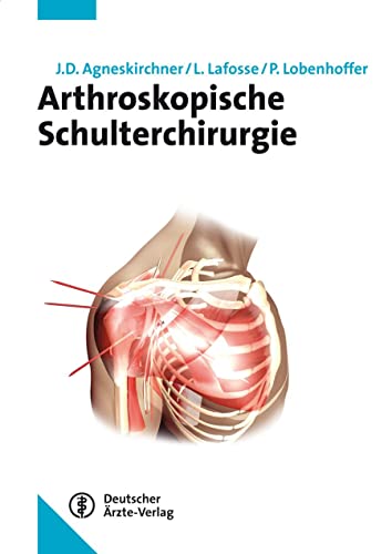 Arthroskopische Schulterchirurgie von Deutscher Aerzte Verlag