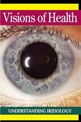 Visions of Health: Understanding Iridology von Avery