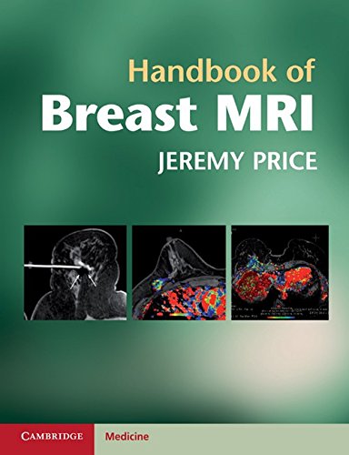 Handbook of Breast MRI (Cambridge Medicine (Paperback)) von Cambridge University Press