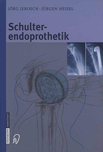 Schulterendoprothetik: Indikation, Implantate, Op-Technik, Nachbehandlung, Begutachtung (German Edition) von Springer